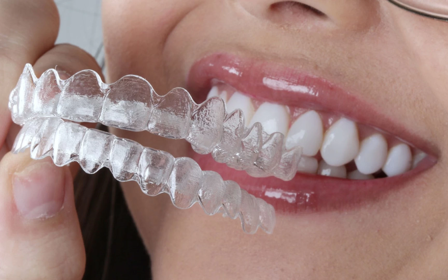 Invisalign