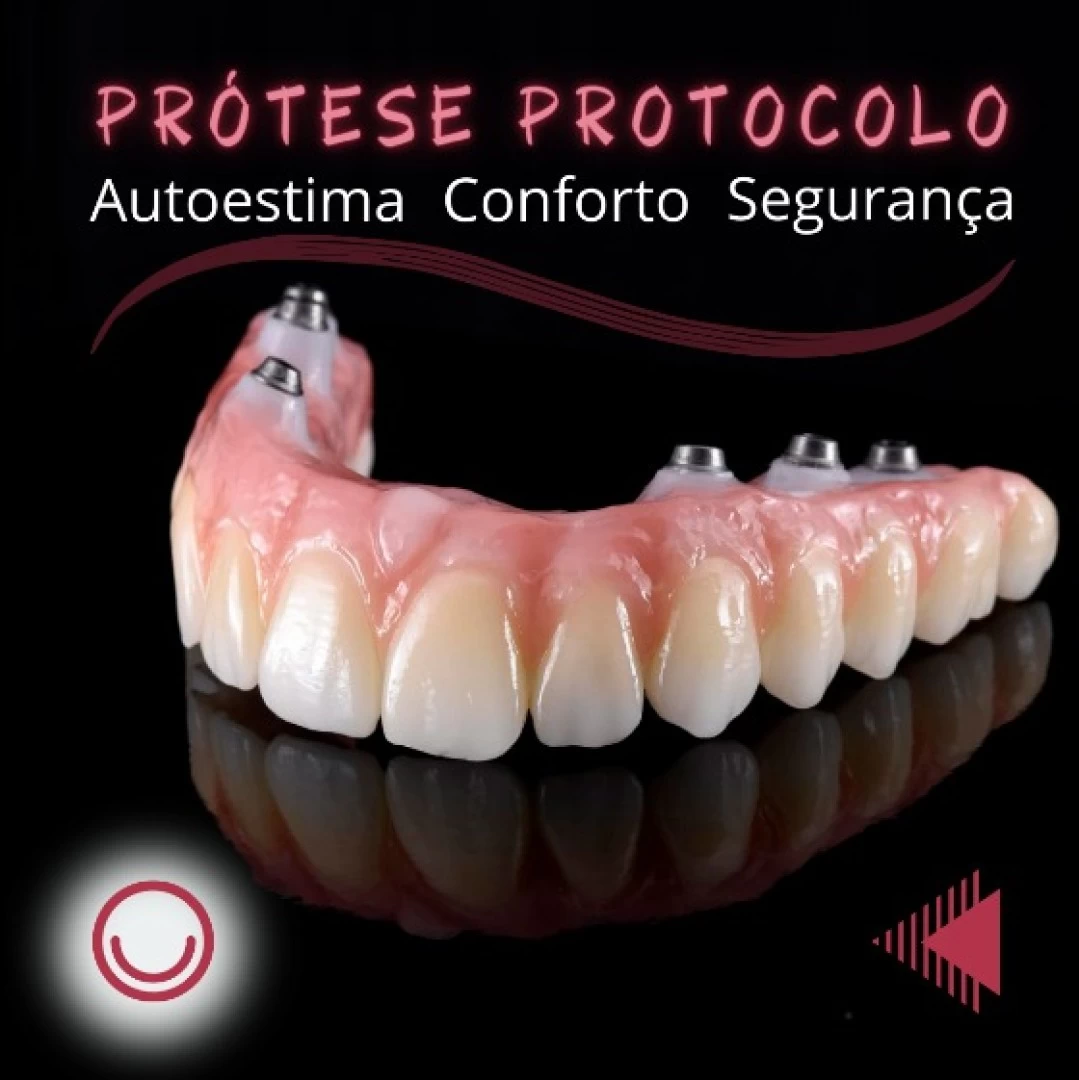 Prótese Protocolo